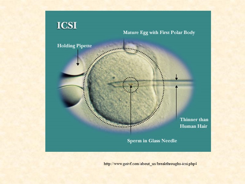 http://www.goivf.com/about_us/breakthroughs-icsi.php4